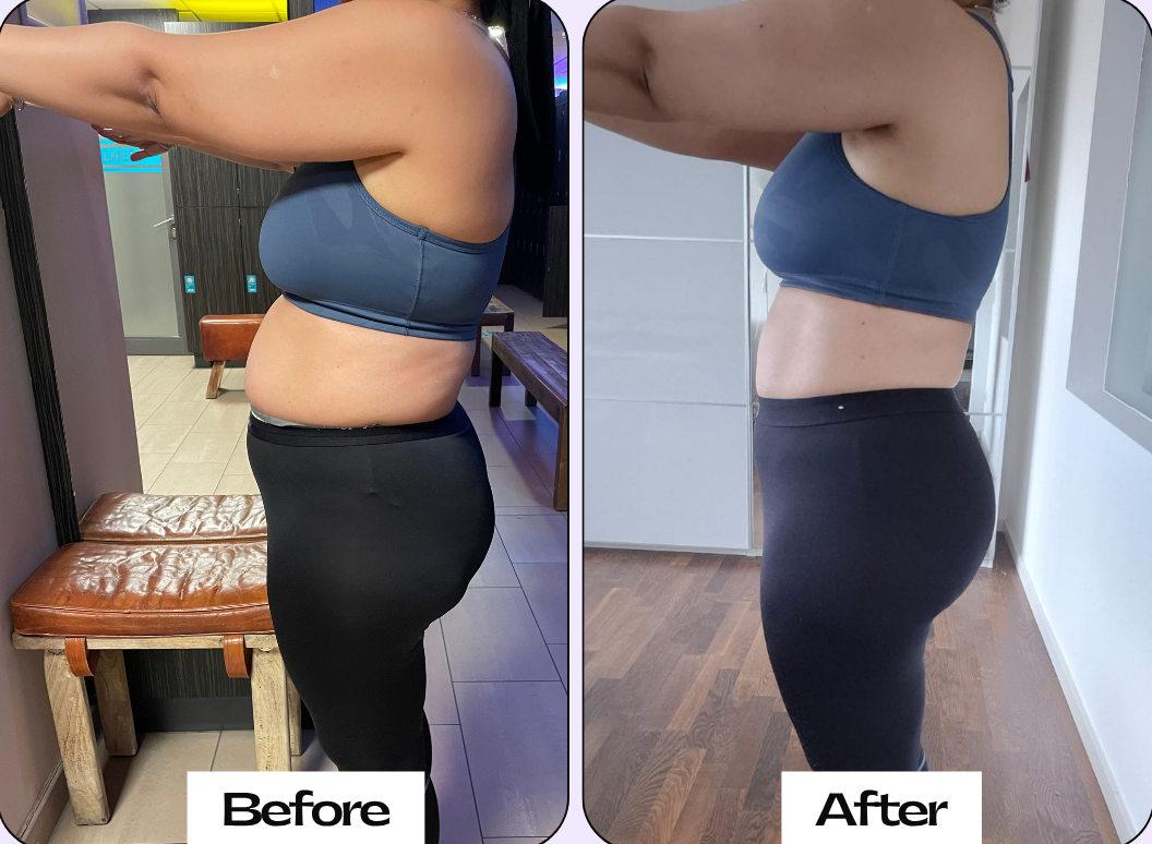 Neutral Before and After Instagram Post - 21