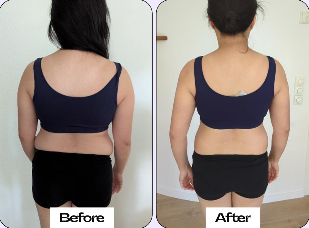 Neutral Before and After Instagram Post - 22