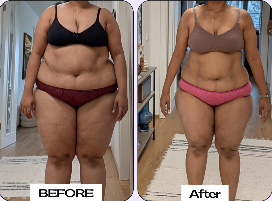 Neutral Before and After Instagram Post - 3