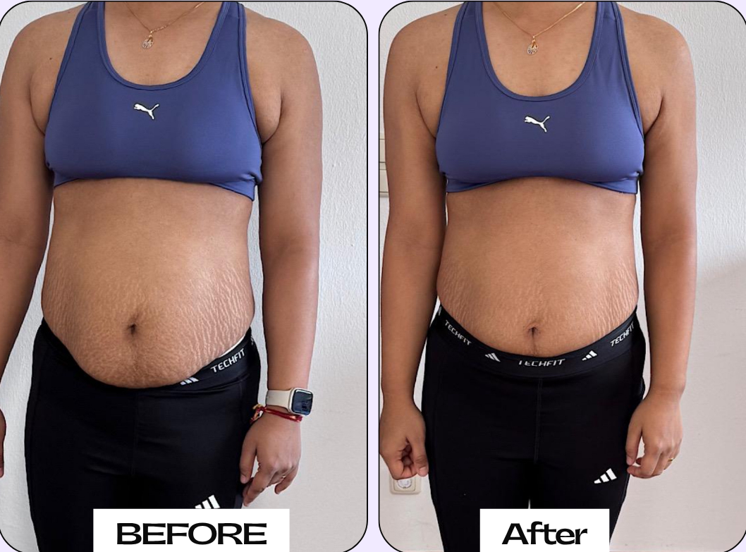 Neutral Before and After Instagram Post - 6